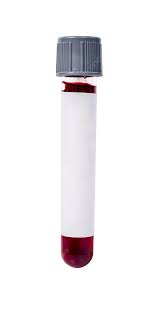 Vacuum Blood Collection Tubes